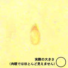 写真：実際の大きさとの比較